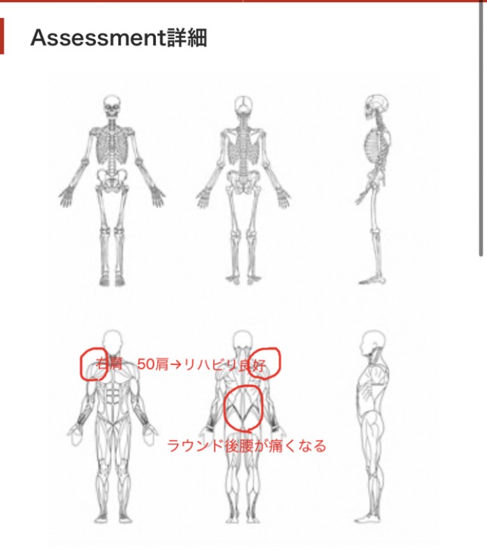 iOS の画像